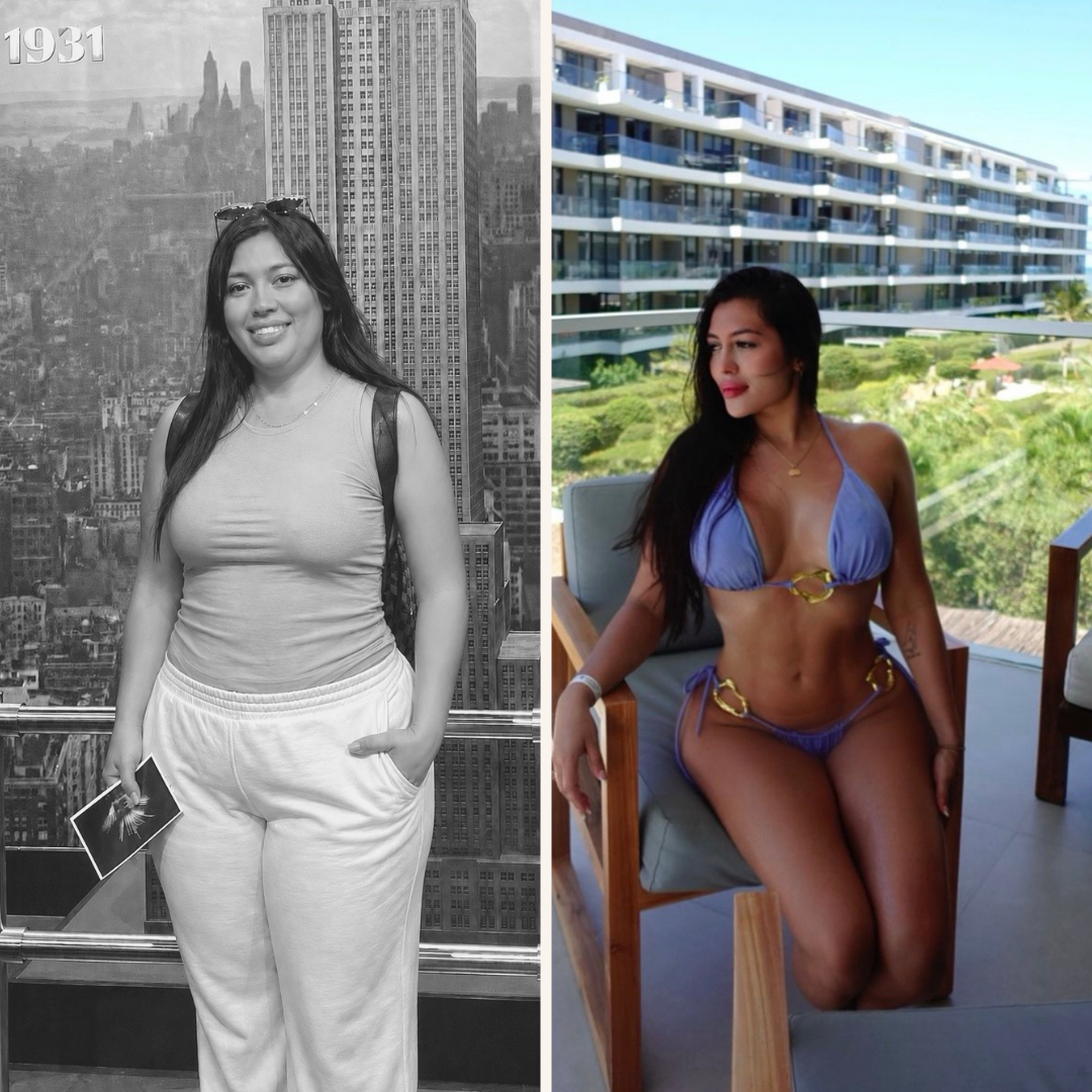 Antes y después del tratamiento BALMA — Claudia R.
